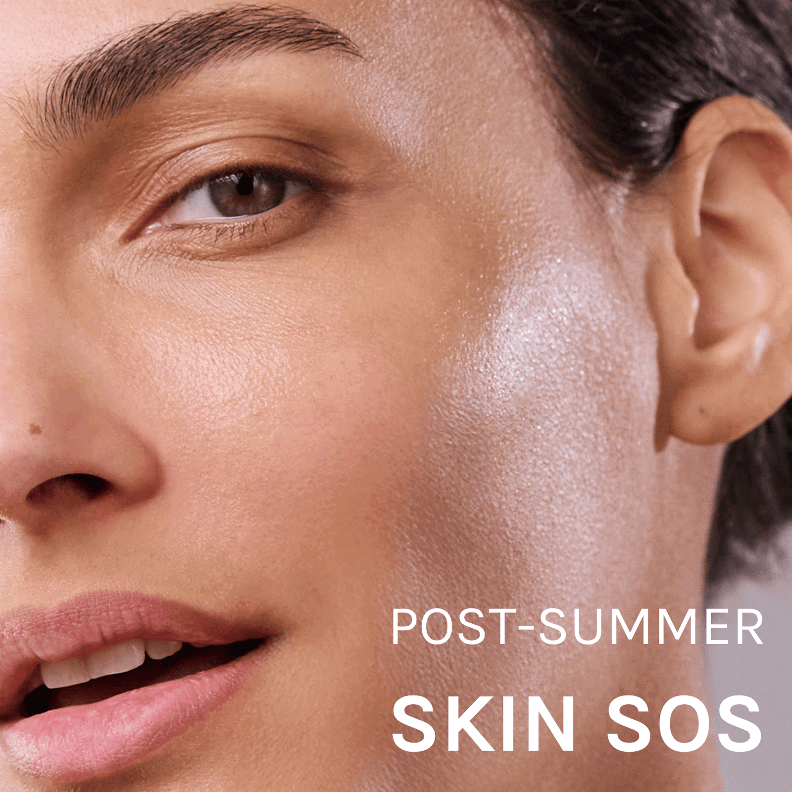 post-summer skin sos