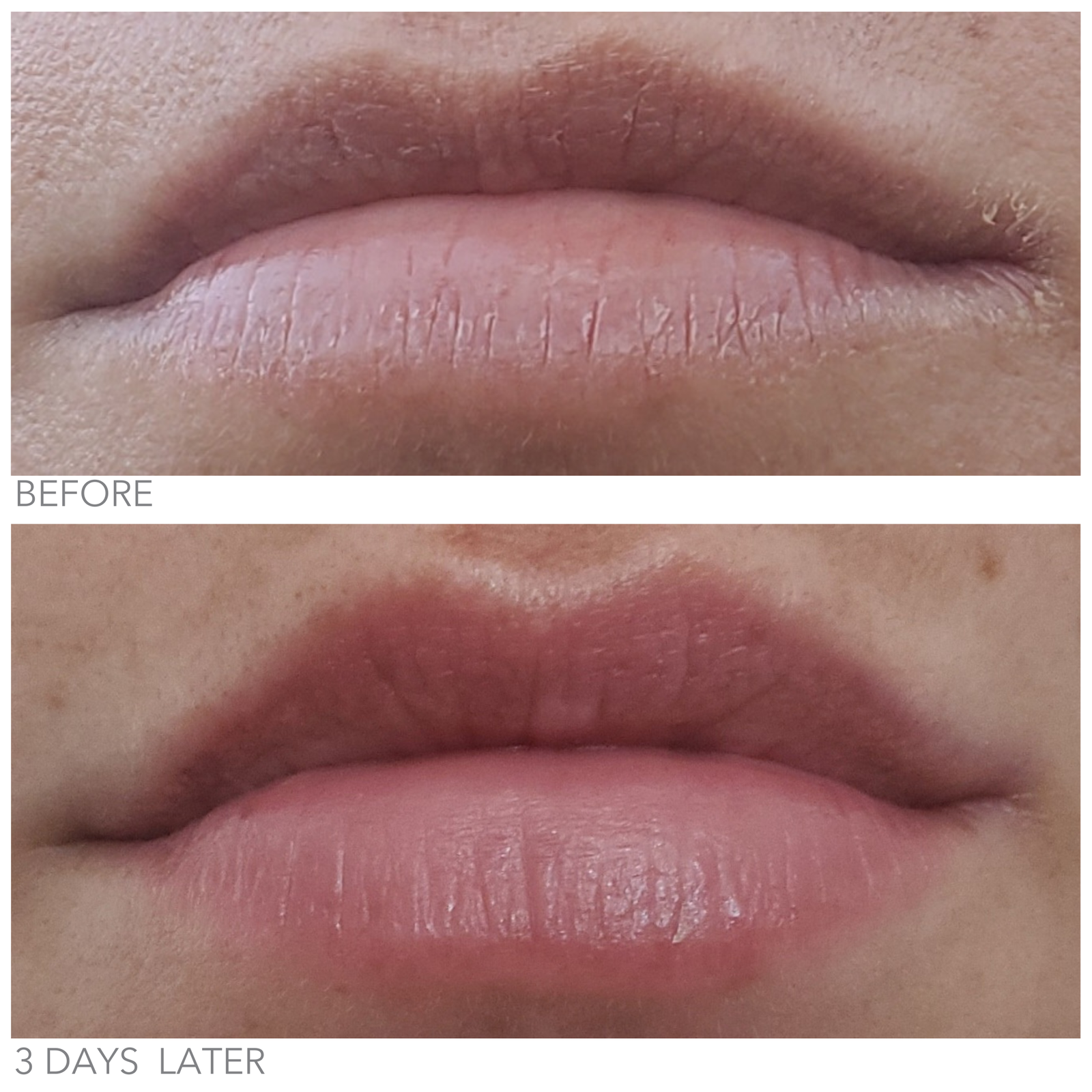 Lip Serum