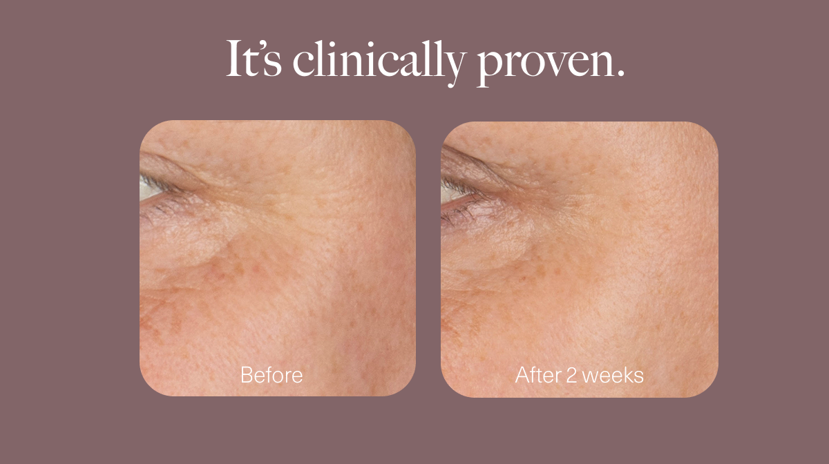 intesnse replenishing serum 