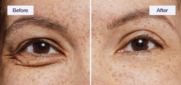 Shop 40% Off Eye Lift Wand