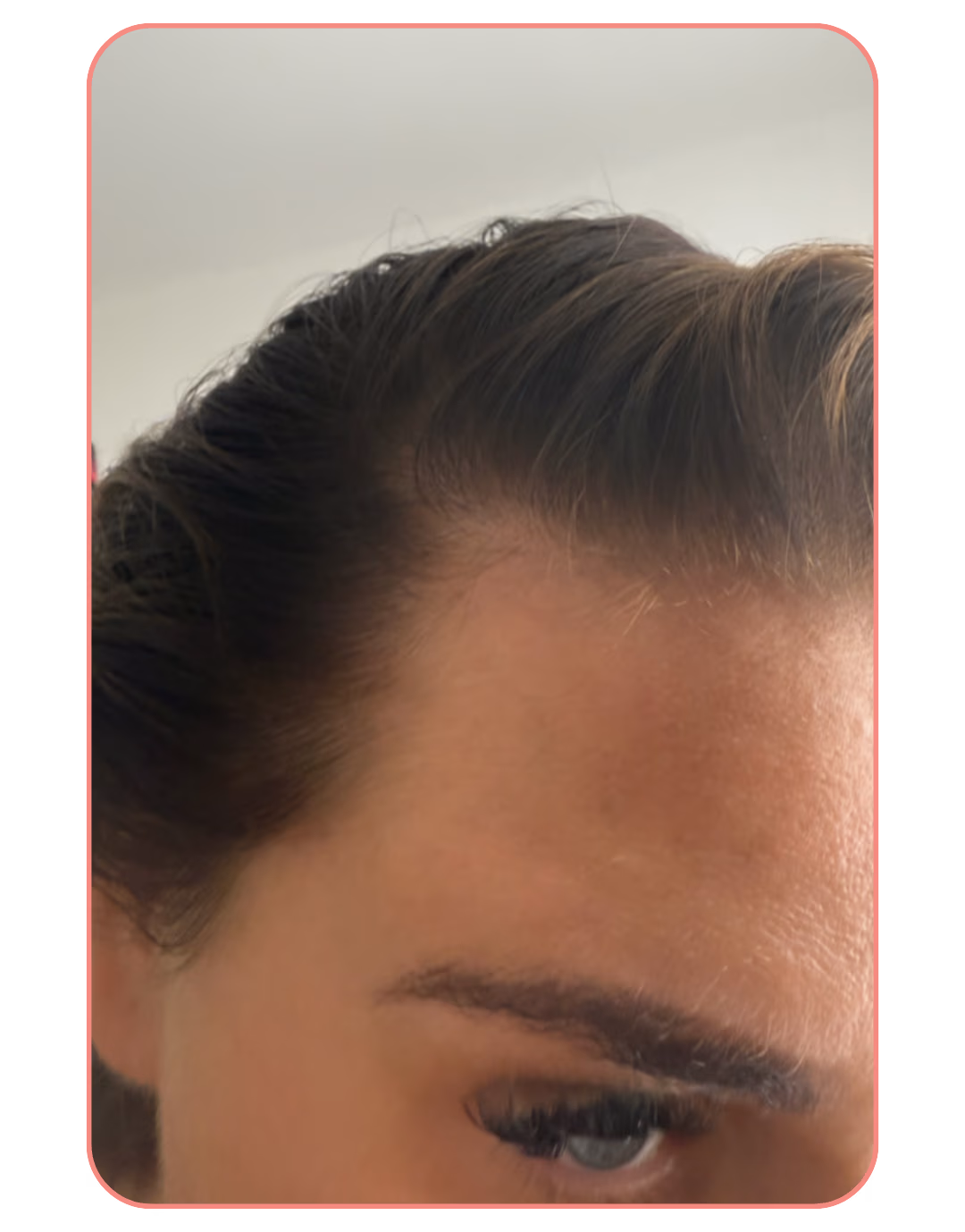 Kayleigh before using Hairburst