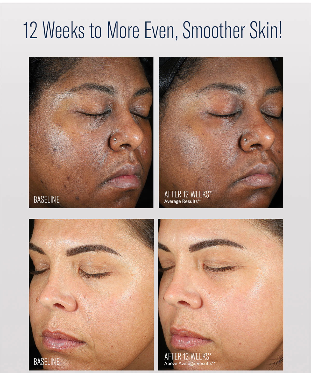 smoother skin
