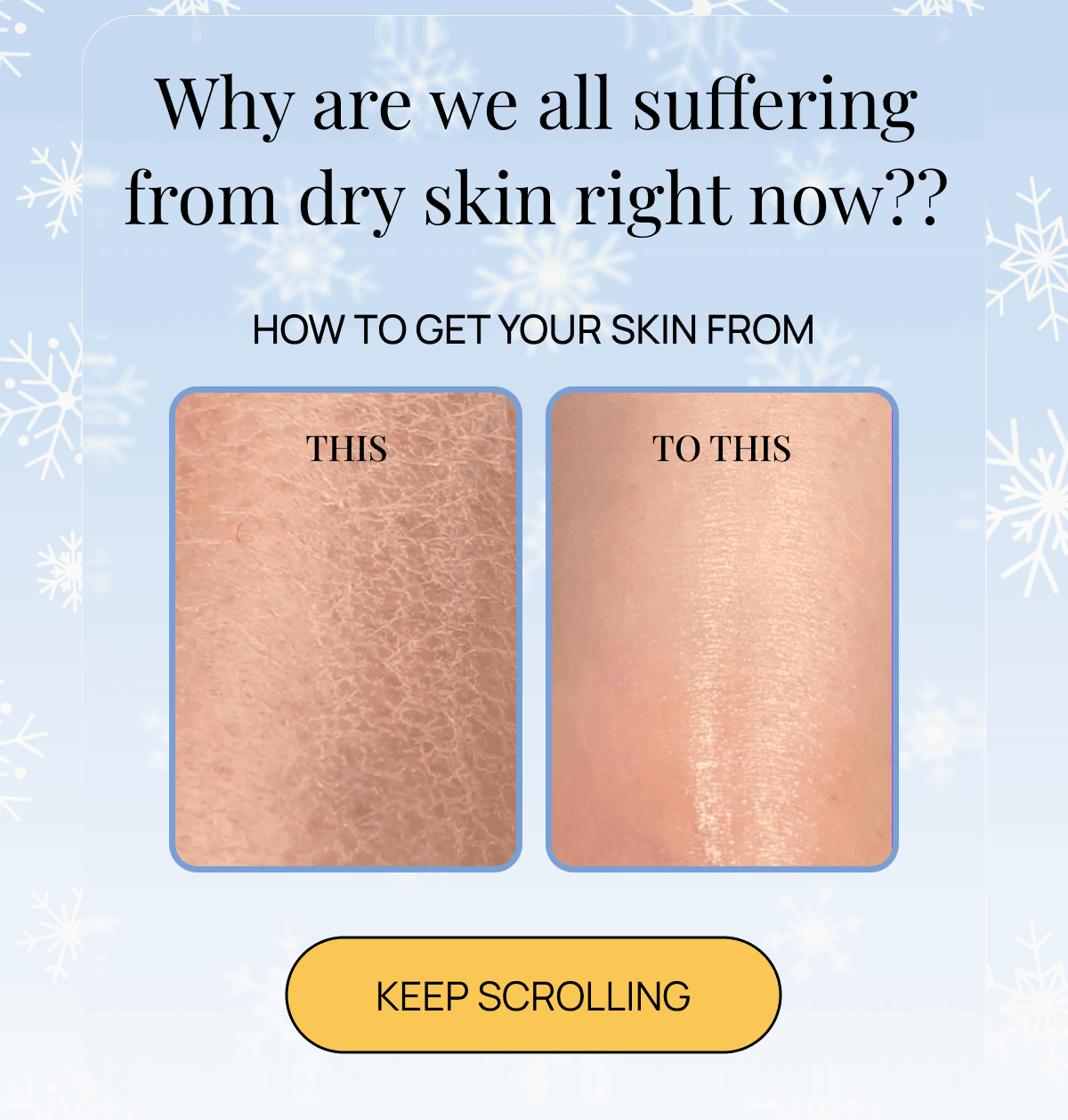 Side-by-side skin comparison showing dry flaky texture versus smooth hydrated skin on a blue background