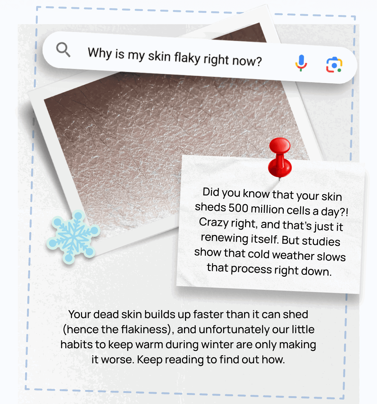 Google search bar asking why skin is flaky, with a polaroid of dry skin and a pinned note about cold weather slowing cell renewal