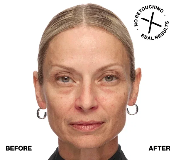 NO RETOUCHING | REAL RESULTS | BEFORE | AFTER