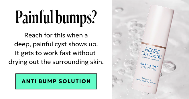 Painful blemishes? Shop Anti Bump Solution.