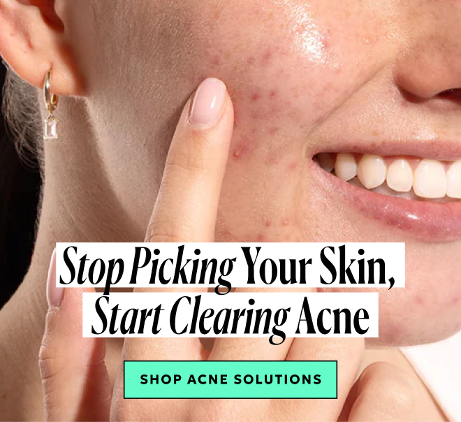 Stop picking your skin, start clearing acne. Shop acne solutions!