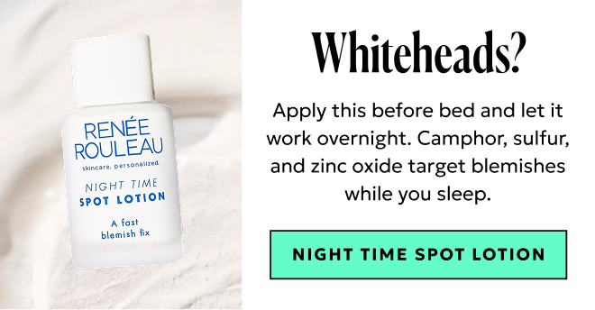 Whiteheads? Shop Night Time Spot Lotion.