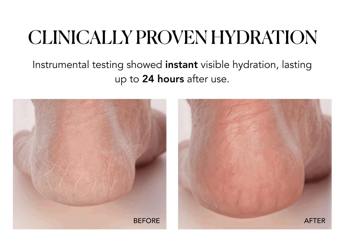 instrumental testing showed improved skin hydration up to 24 hours after use. 