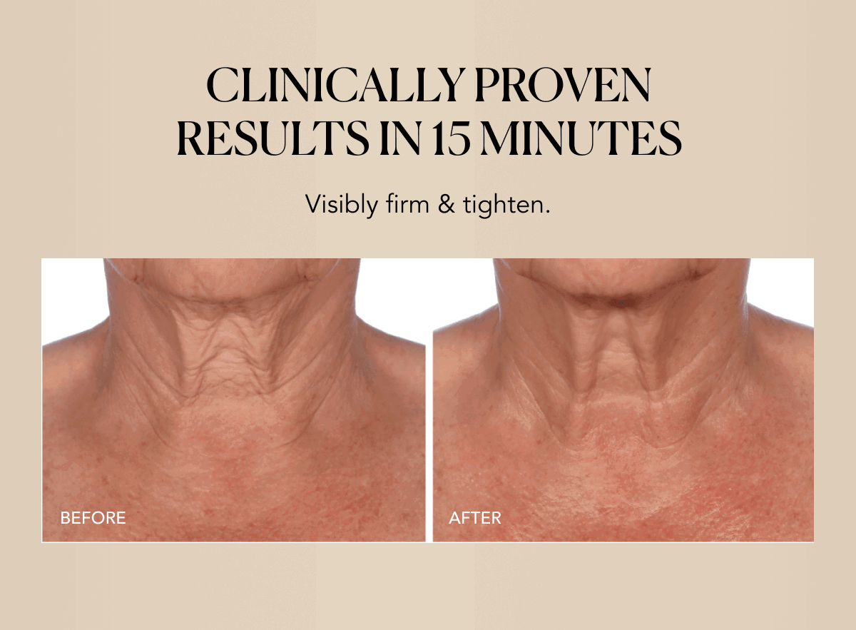 visibly firm and tighten for up to 24 hours