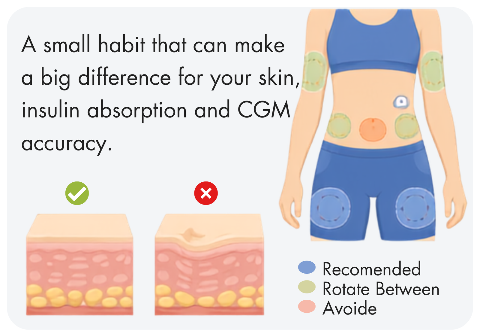 How to Rotate Injection & CGM Sites the Ultimate Guide