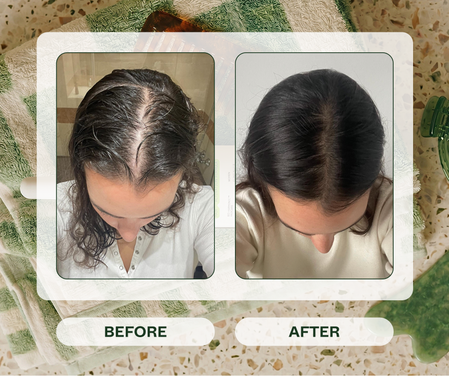 Before & After