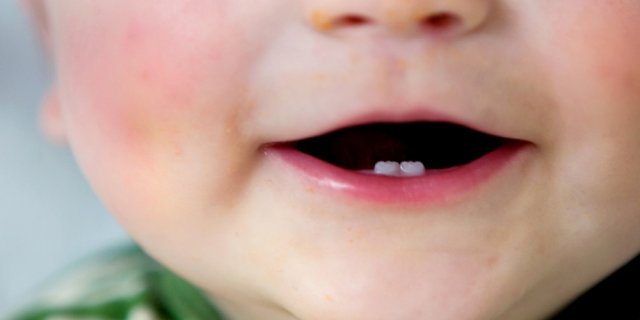 bébé naître avec dents
