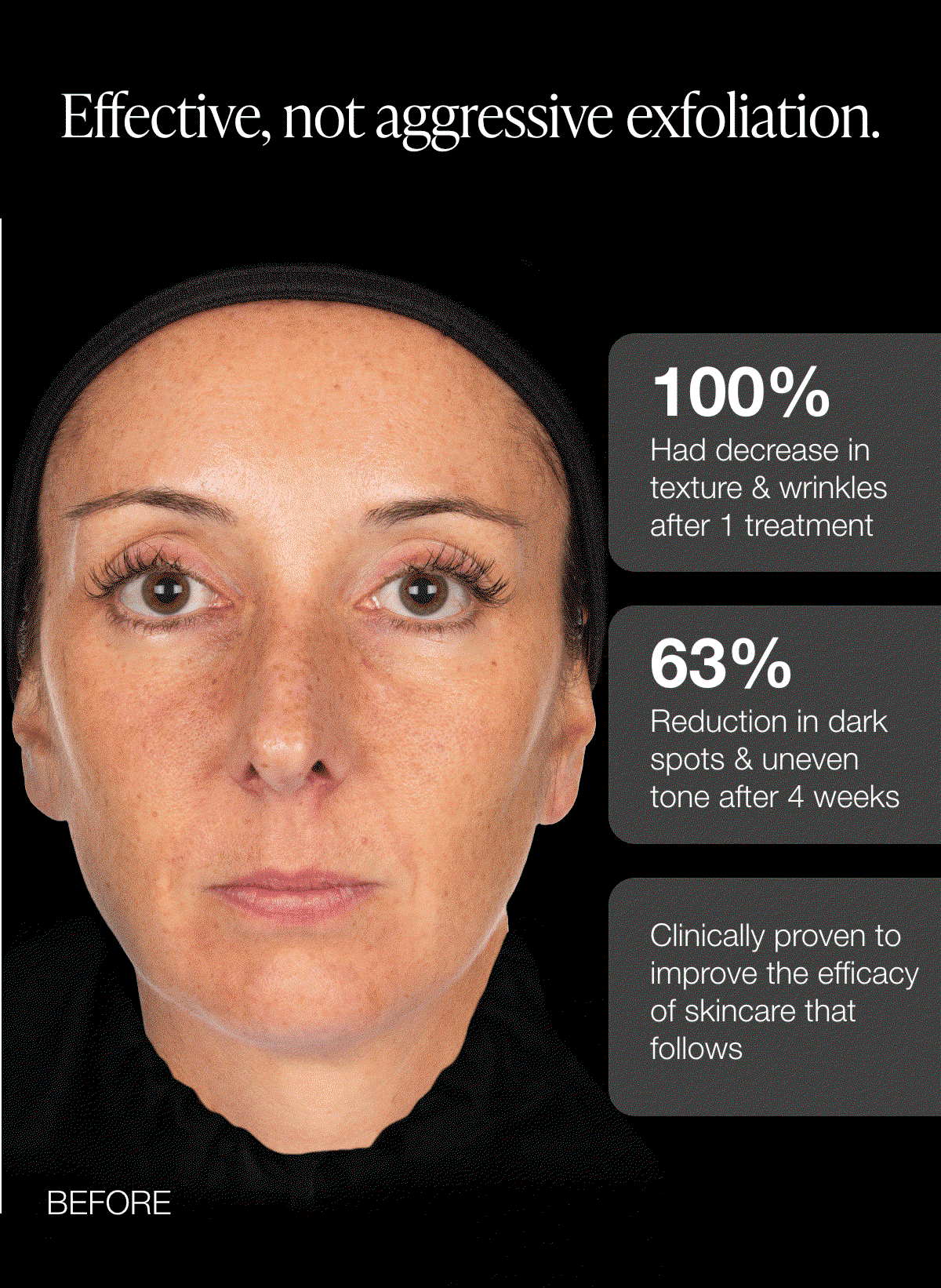 Skin Prep Exfoliating Pads Brightening & Smoothing Toner Pads $56.00