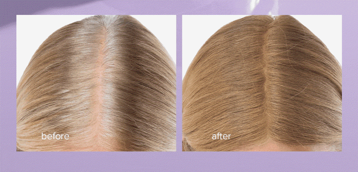 Before/After
