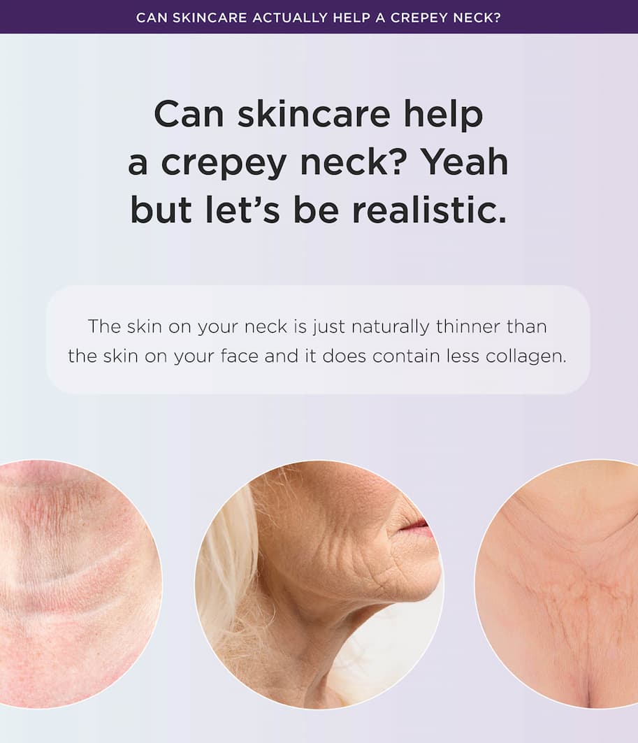 Crepey Skin