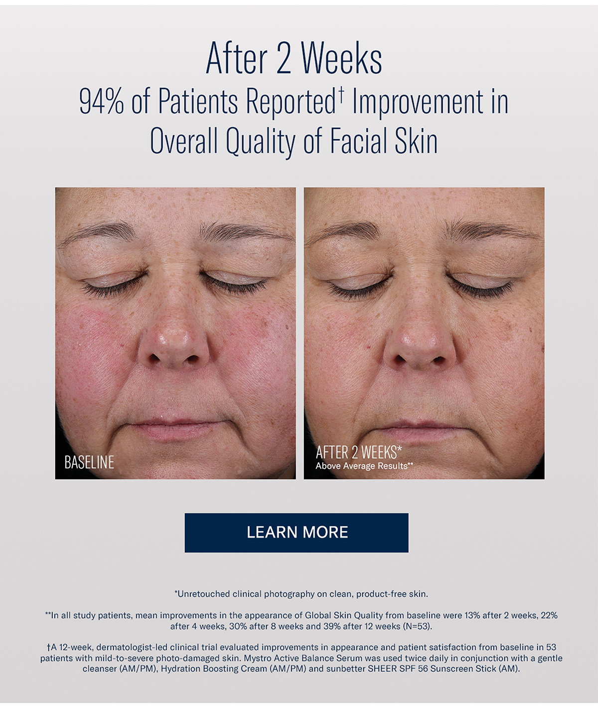appearance of redness