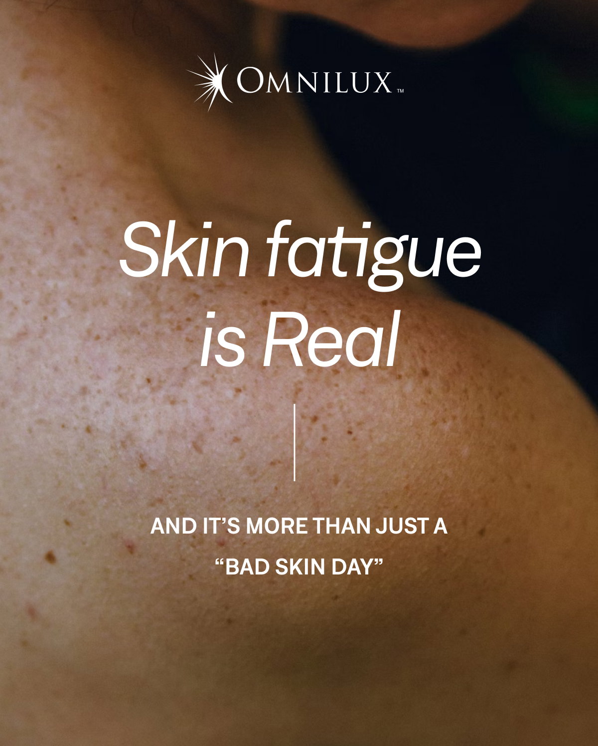 Introducing the concept of skin fatigue as something distinct from typical aging.