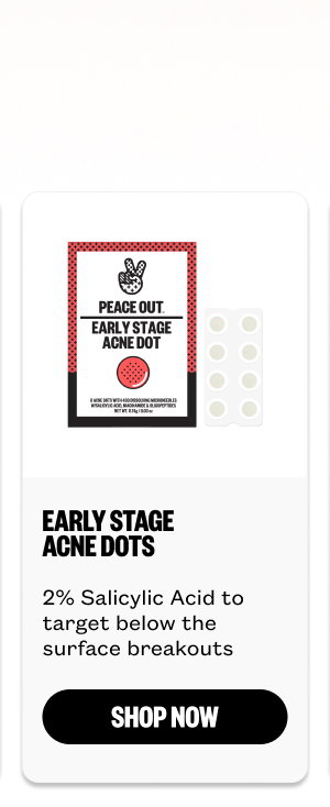 Early Stage Acne Dots