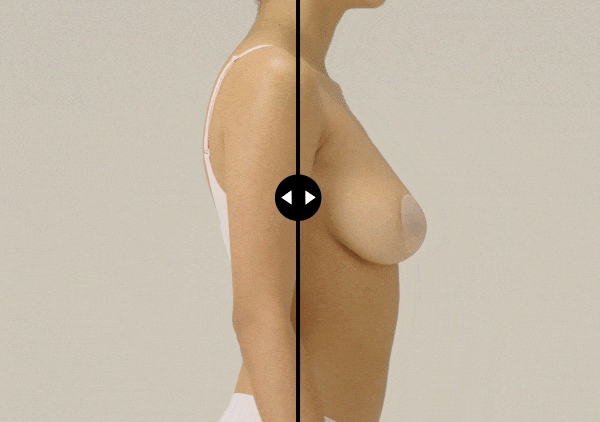 Boob Job Bra