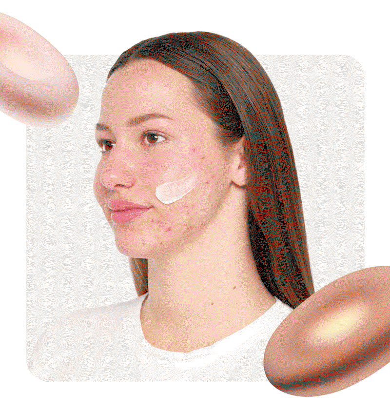 Know the different types of blemishes.