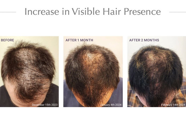 Hair Serum