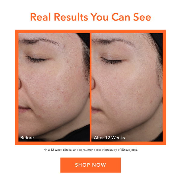 Real Results