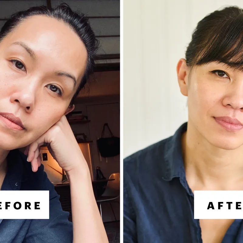 On the left, a photo of woman when she was getting Botox and fillers and on the right, the same woman after she stopped those beauty treatments.