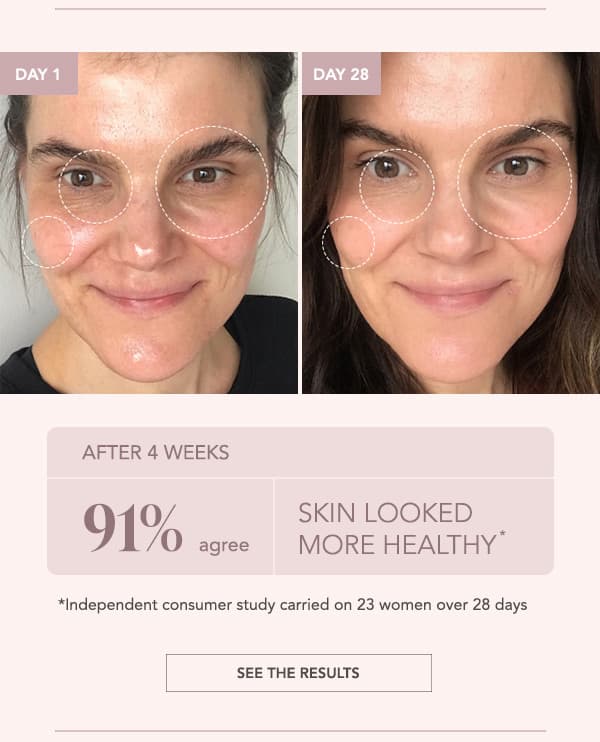 Day 1 vs Day 28 — 91% agree skin looked more healthy after 4 weeks, in a 23-woman study — See The Results