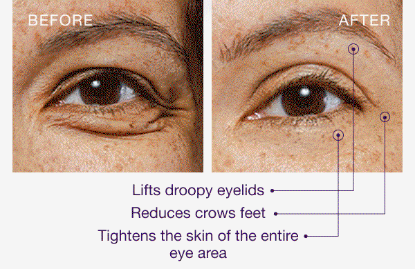 Shop 40% Off Eye Lift Wand