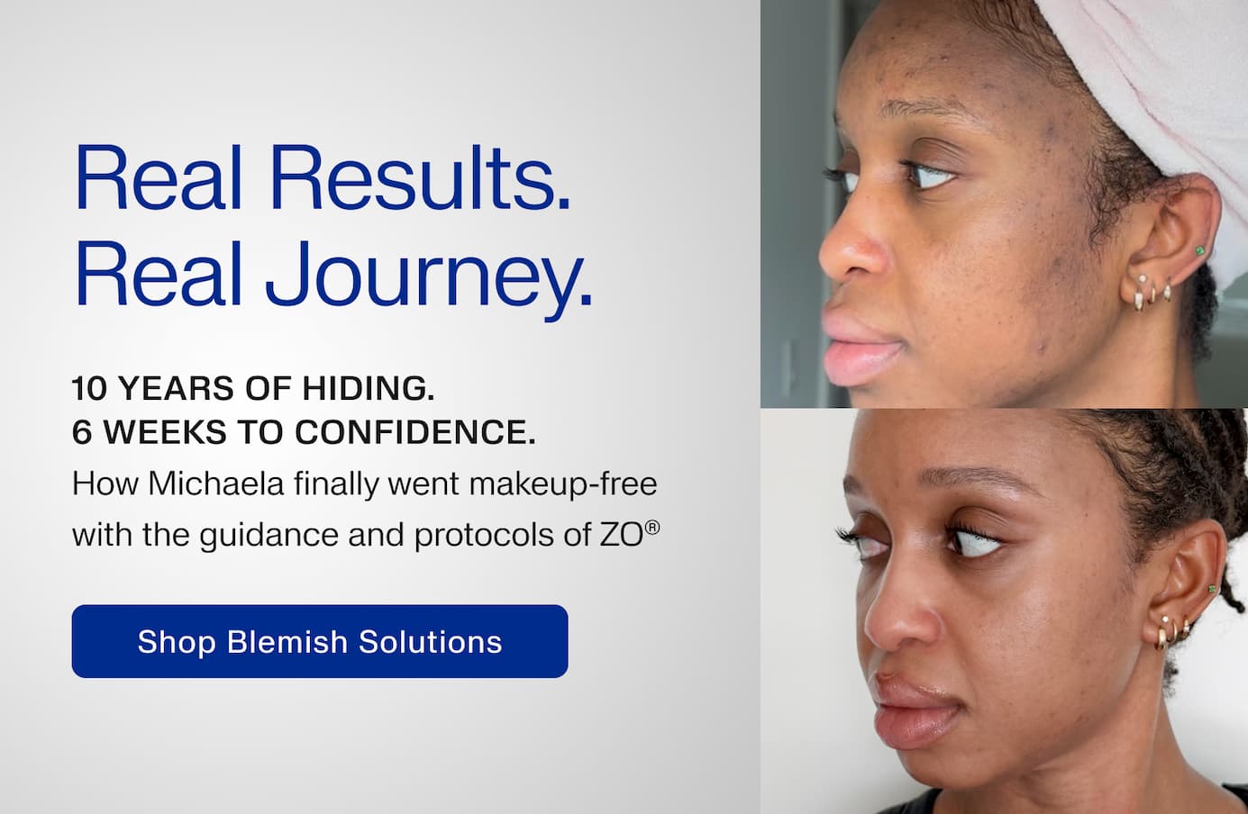 Real Results. Real Journey.