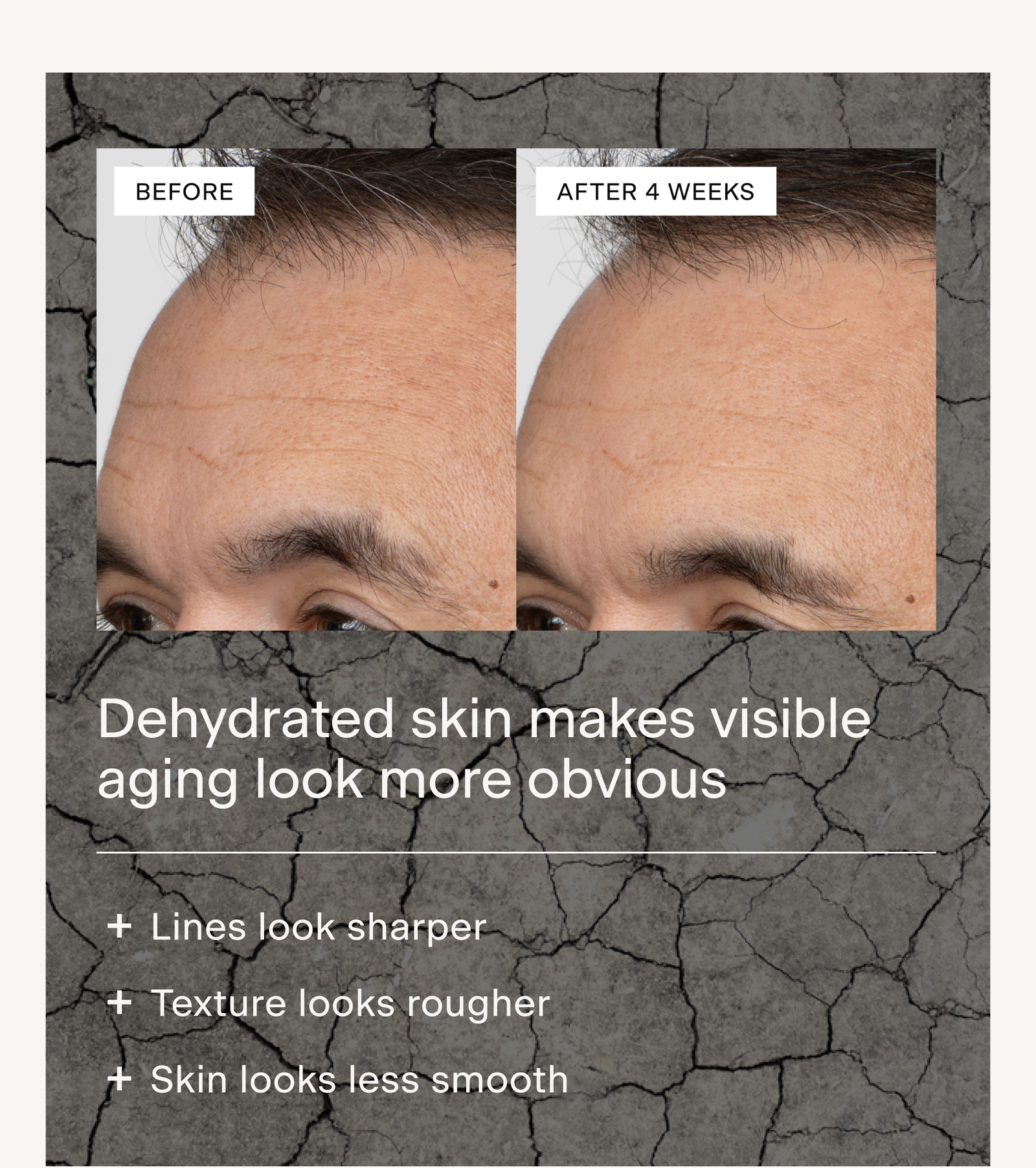 DEHYDRATED SKIN MAKES VISIBLE AGING LOOK MORE OBVIOUS