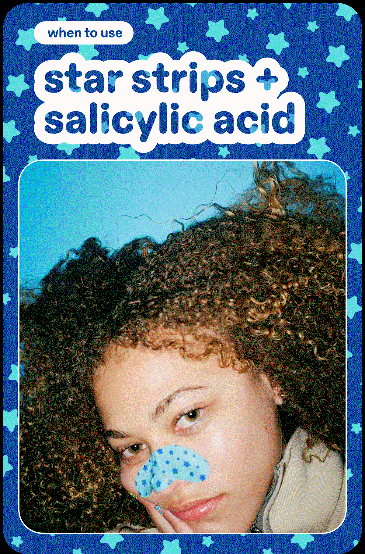 when to use star strips + salicylic acid