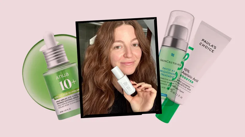 Image contains an Allure editor holding the Shani Darden Skin Care Rescue Serum with 10% Azelaic Complex surrounded by a collage of the best azelaic acid serum silos