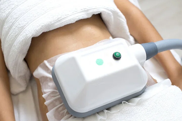 Fettfrysning med Cryo Extreme hos Hazar Beauty i Sundbyberg