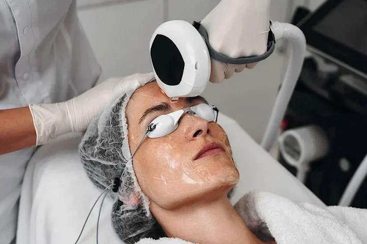 IPL-behandling 3 tillfällen hos Blanka Kliniken på Södermalm