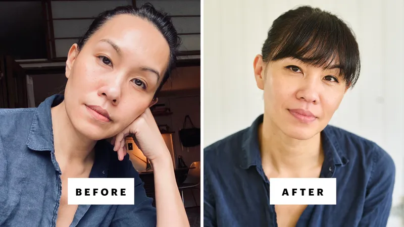 On the left, a photo of woman when she was getting Botox and fillers and on the right, the same woman after she stopped those beauty treatments.