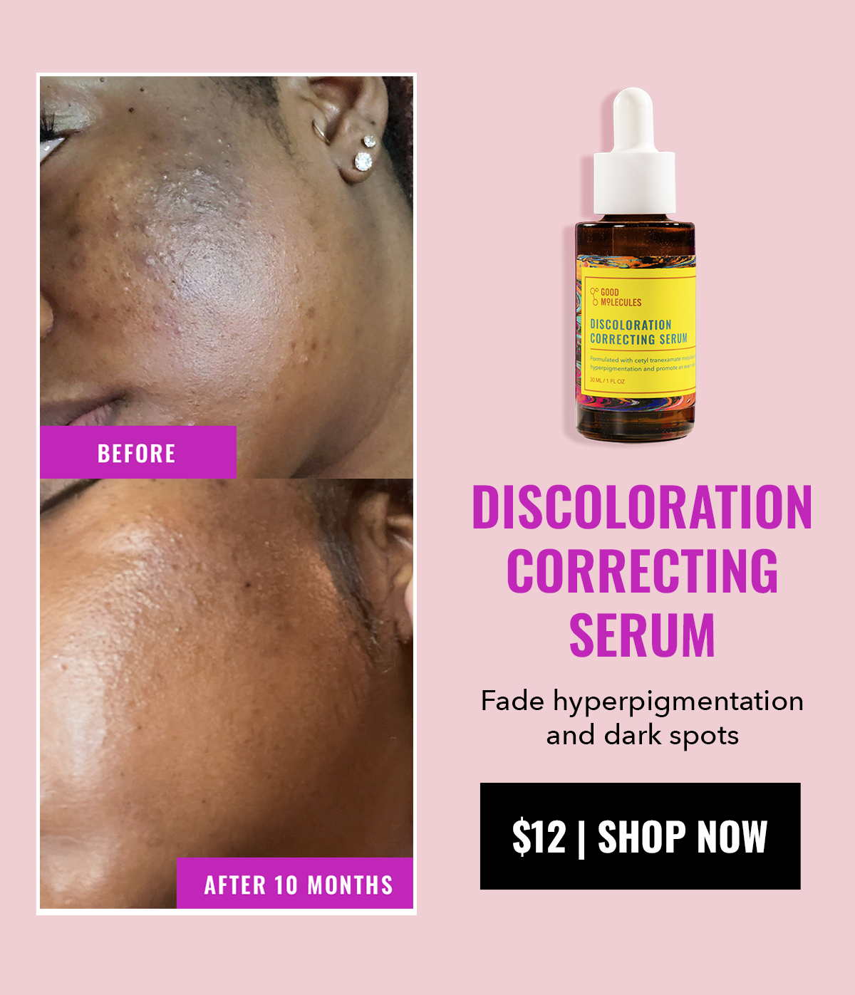 Discoloration Correcting Serum - $12