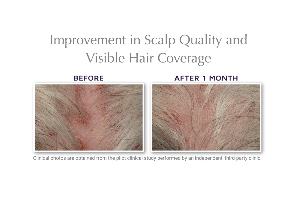 Hair Serum