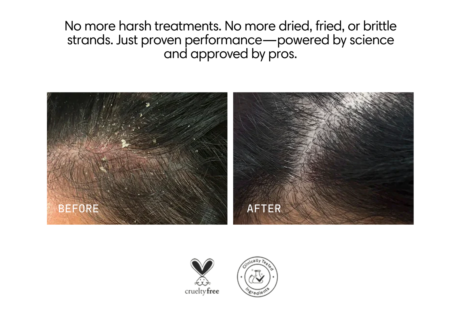 Before and after: flaky scalp cleared to healthy hair with Jupiter's proven, cruelty-free formula.