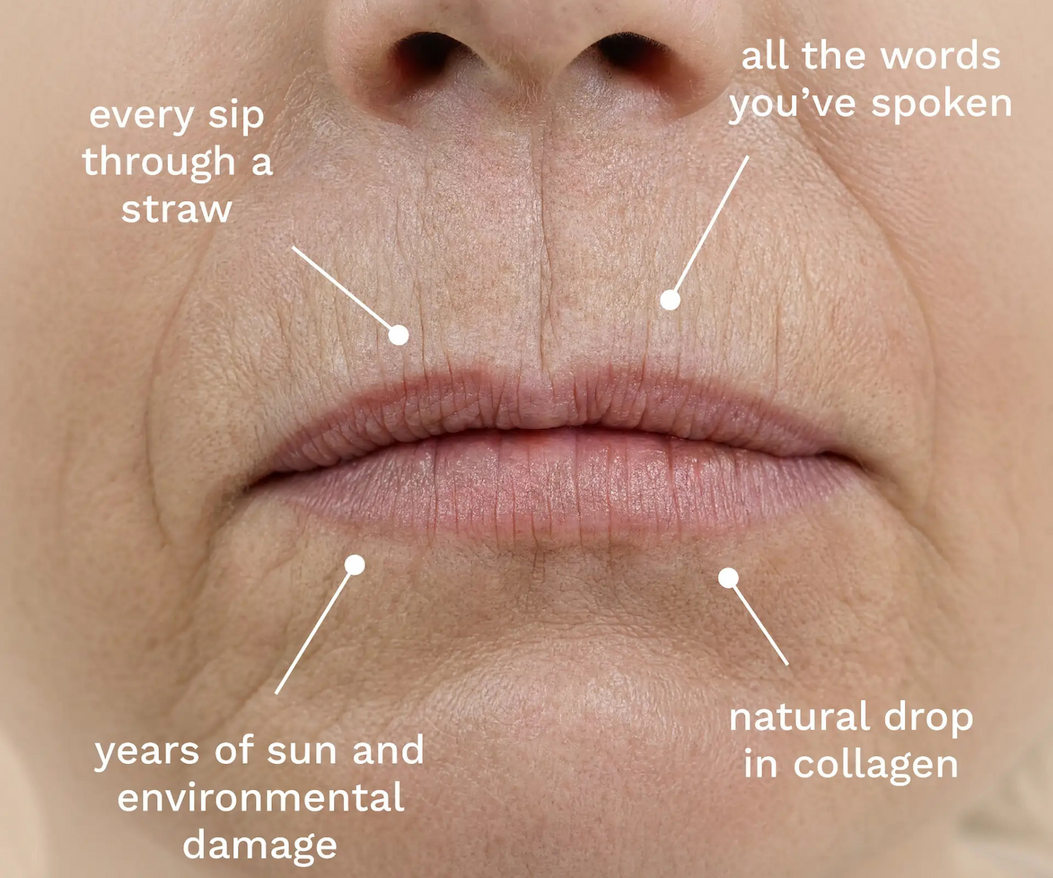 Give your lips the nourishment it deserves! Shop City Lips® Line Therapy and take 40% off. 💄