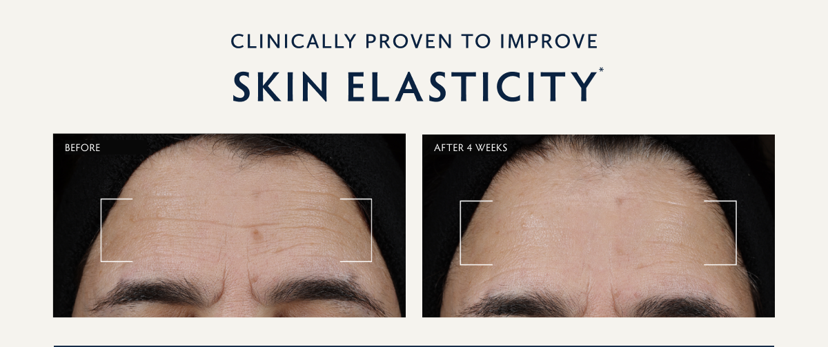 Clinically Proven to Improve Skin Elasticity