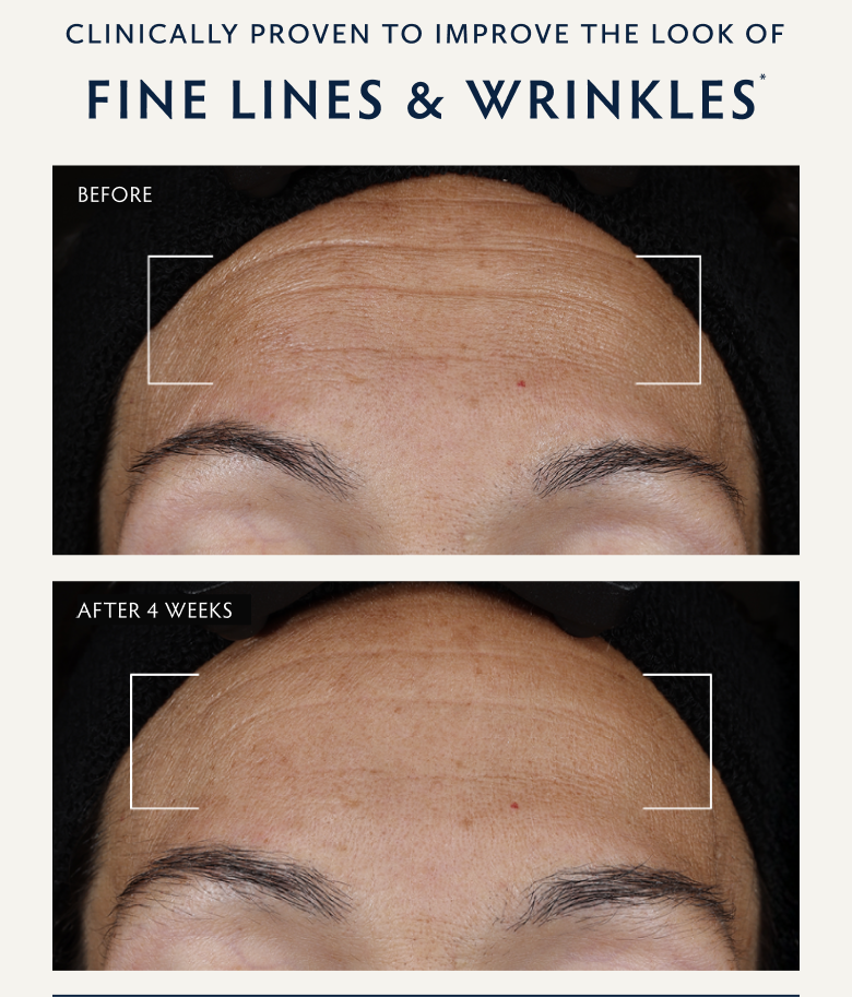 Clinically Proven to Improve the Look of Fine Lines & Wrinkles
