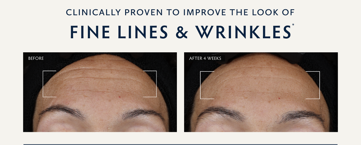 Clinically Proven to Improve the Look of Fine Lines & Wrinkles