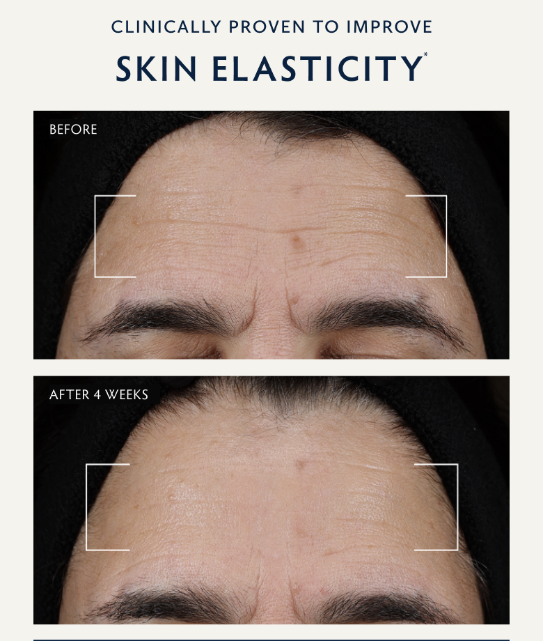 Clinically Proven to Improve Skin Elasticity