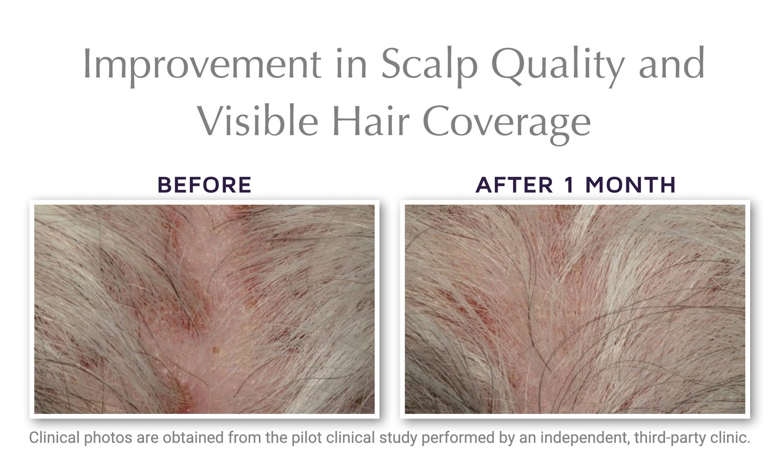 Hair Before & After