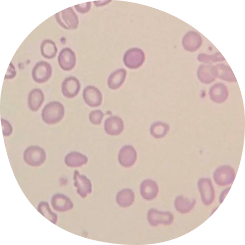 Biomarker