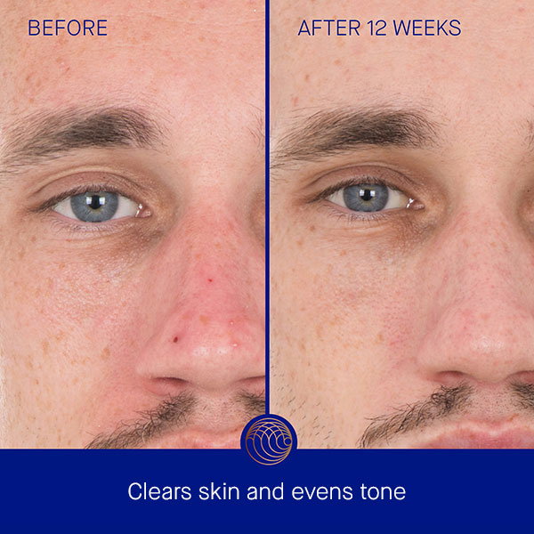 The Retinol Serum