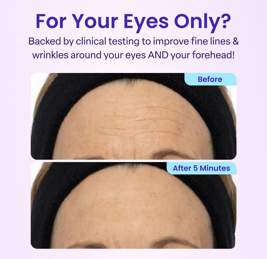 For Your Eyes Only? Backed by clinical testing to improve fine lines & wrinkles around your eyes AND your forehead! Before After 5 Minutes