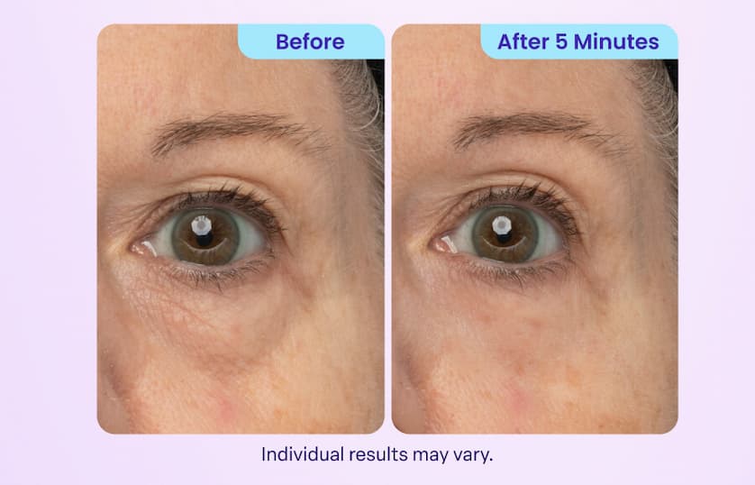 Before After 5 Minutes Individual results may vary.